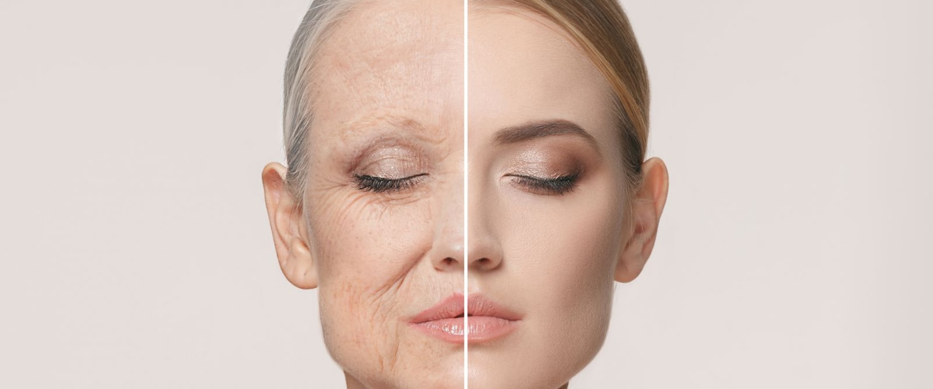 The Benefits of Botox: Enhancing Your Appearance and Fighting the Signs of Aging