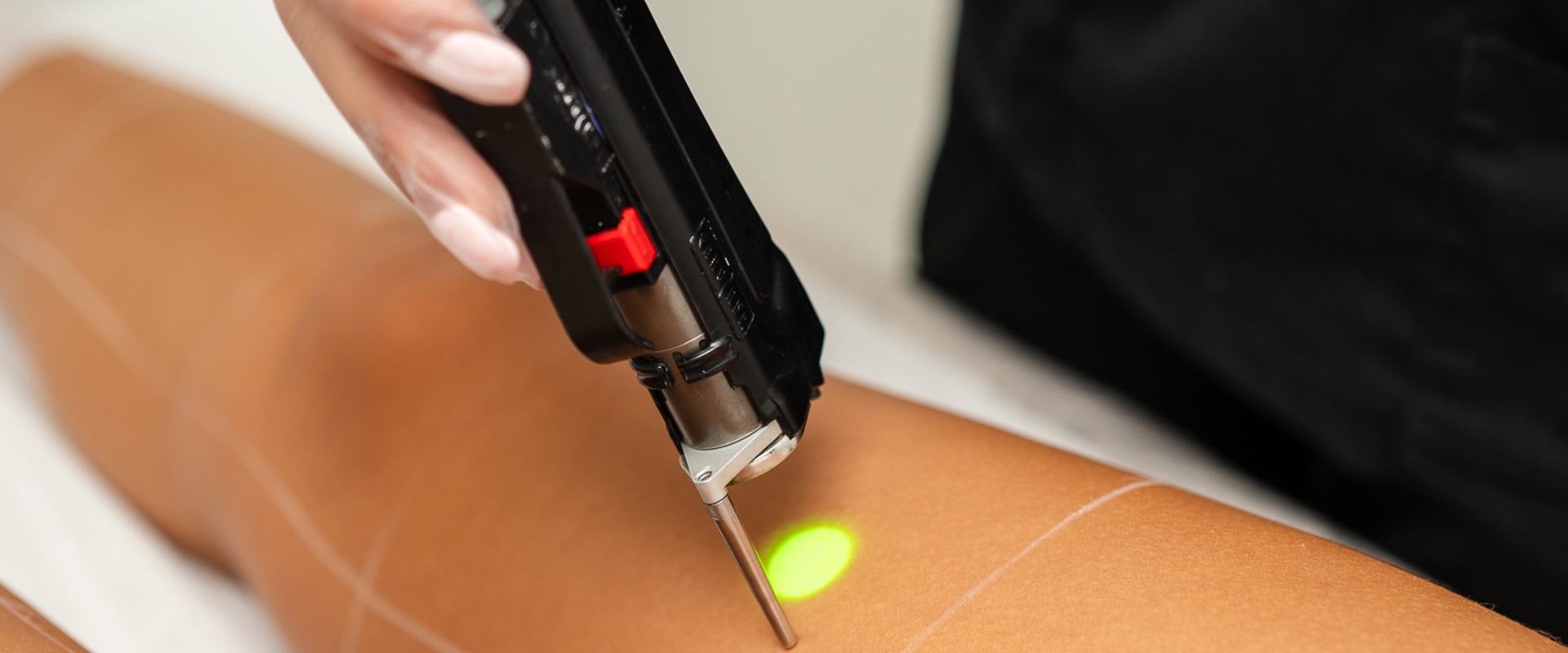 Types of Lasers Used for Hair Removal: A Comprehensive Guide