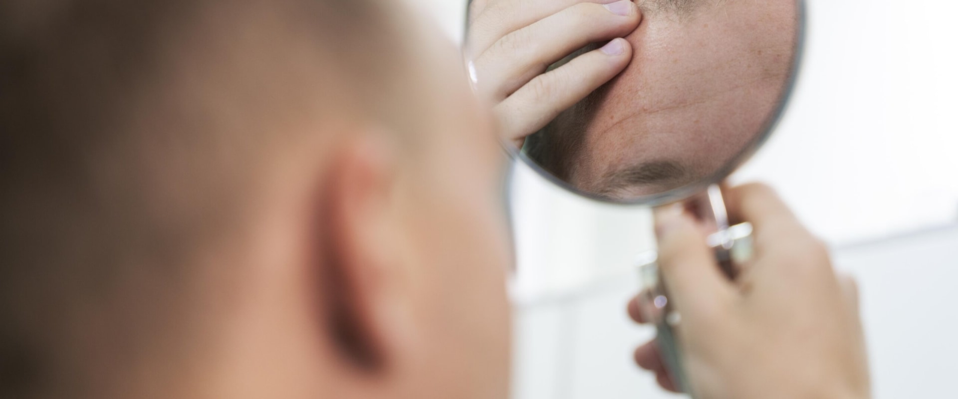 Understanding Genetics and Male Pattern Baldness