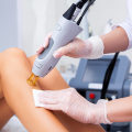 The Amazing Benefits of Laser Hair Removal