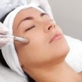 Benefits of Microdermabrasion for Skin Rejuvenation Treatments