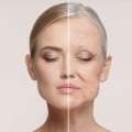 The Benefits of Botox: Enhancing Your Appearance and Fighting the Signs of Aging