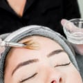 The Benefits of Chemical Peels for Skin Rejuvenation