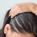 Hairstyles for Thinning Hair: How to Style and Care for Thinning Hair