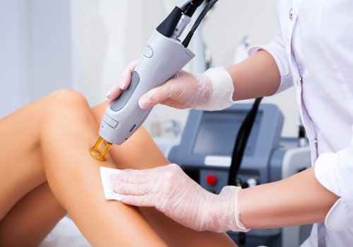 The Amazing Benefits of Laser Hair Removal