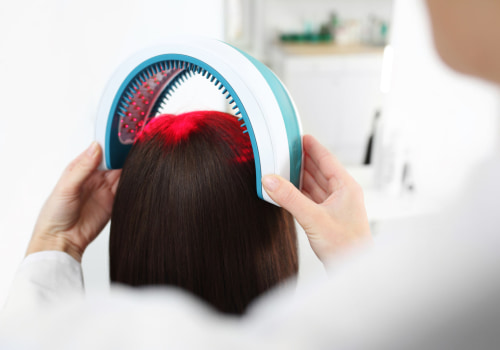 Understanding Low-level Laser Therapy for Hair Loss Treatment