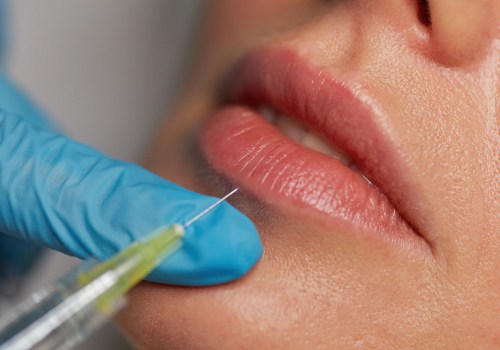 The Truth About Lip Fillers: Understanding the Side Effects and Risks