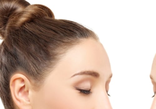 Understanding Hormonal Changes and Female Hair Loss