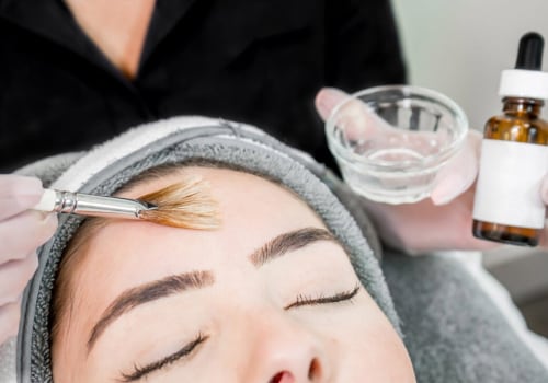 The Benefits of Chemical Peels for Skin Rejuvenation